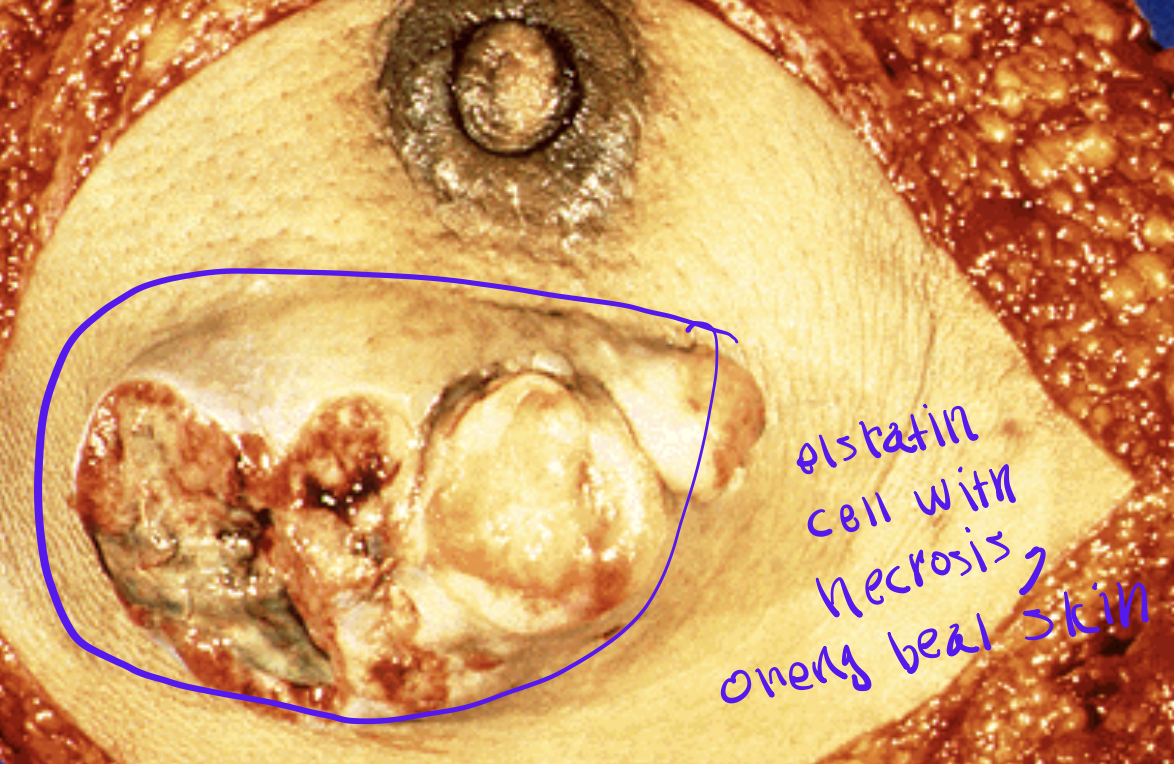 <p>Identify the <strong>organ</strong> and the <strong>diagnosis</strong> in this format: <em>diagnosis, organ</em></p>