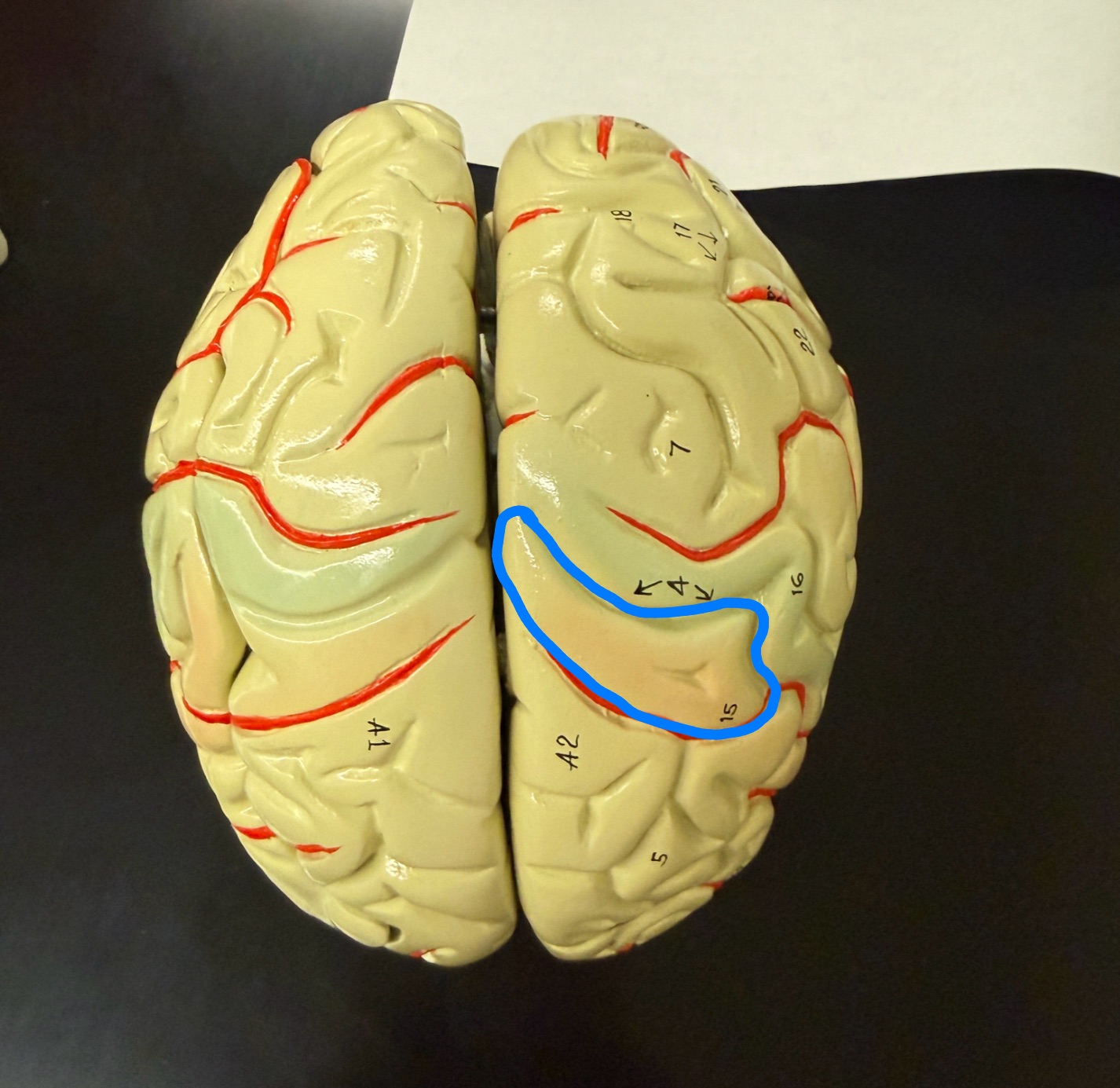 <p>What is outlined in blue on the brain model?</p>