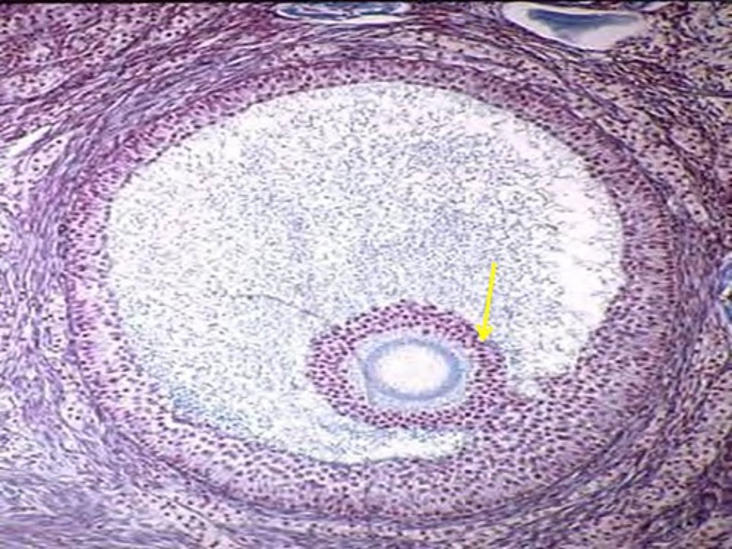 <p>the final-stage follicle that releases the egg during ovulation</p>