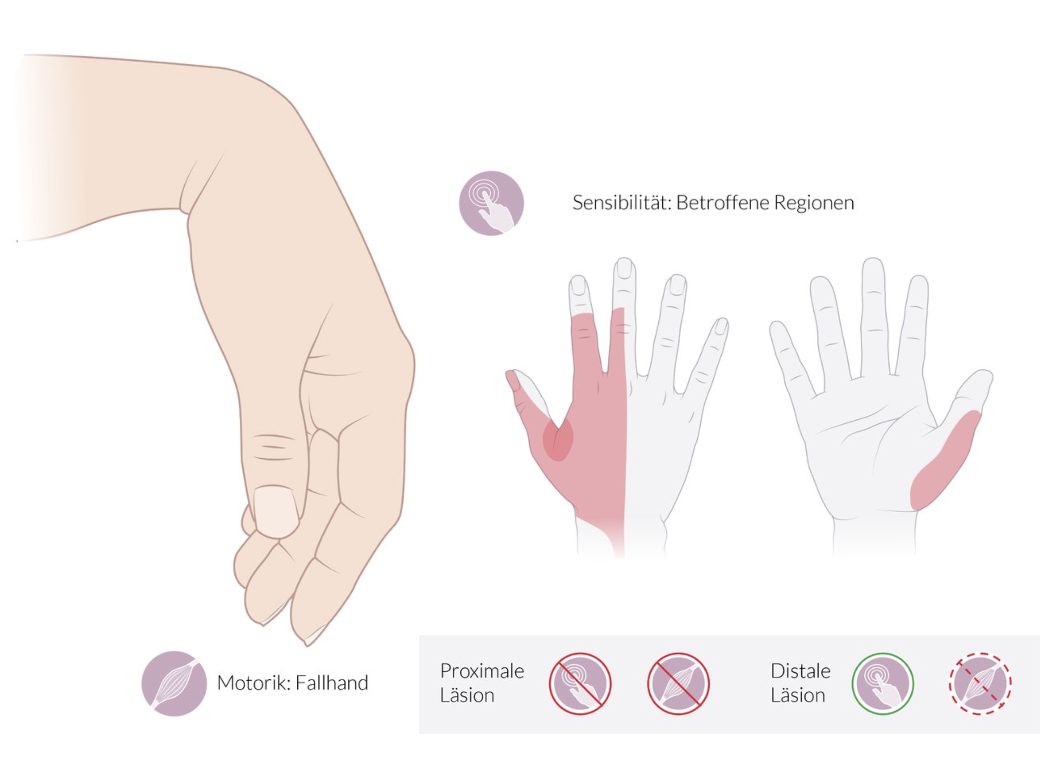 <p>C. Radial groove of the humerus (Sulcus nervi radialis)</p>