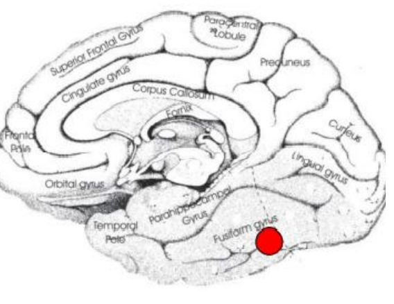 <p>Les agnosies associative</p>