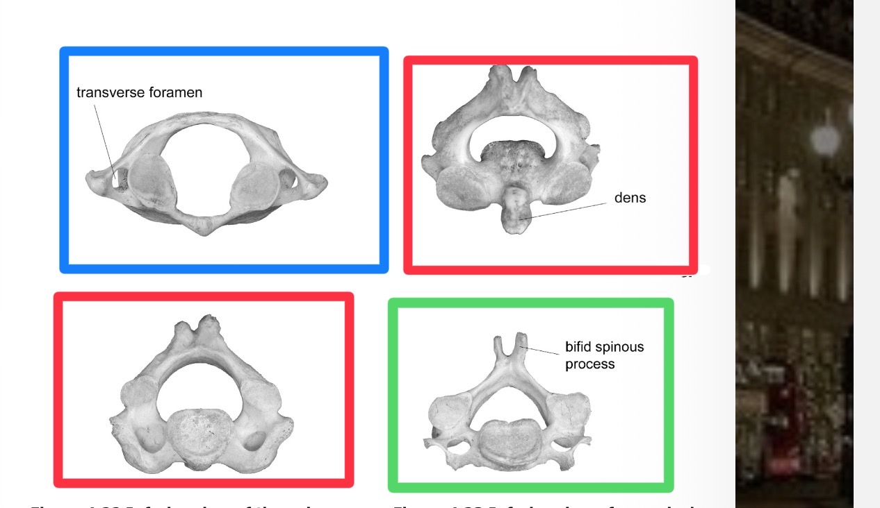 <p>Which is red and which region </p>