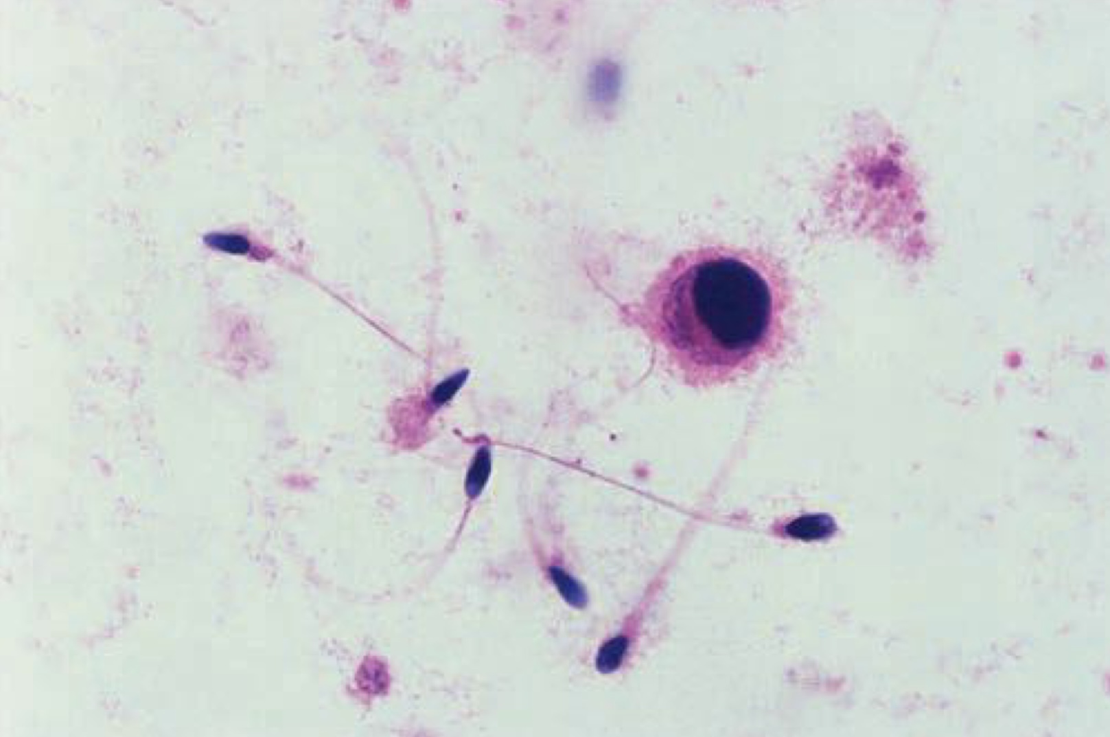 term image