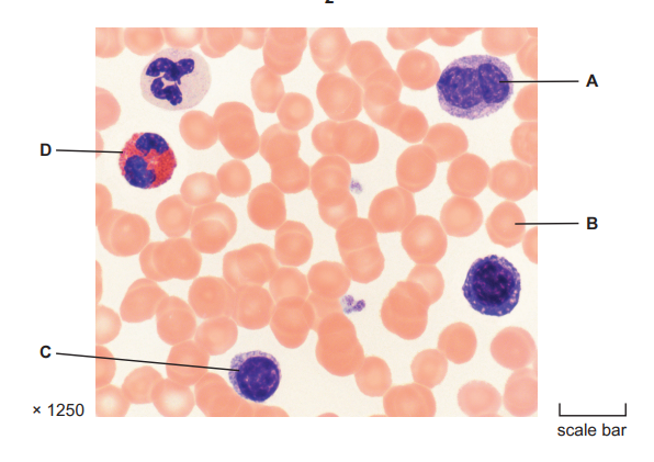 <p>suggest and explain why the cytoplasm of cell C and D reacted differently to the stain</p>