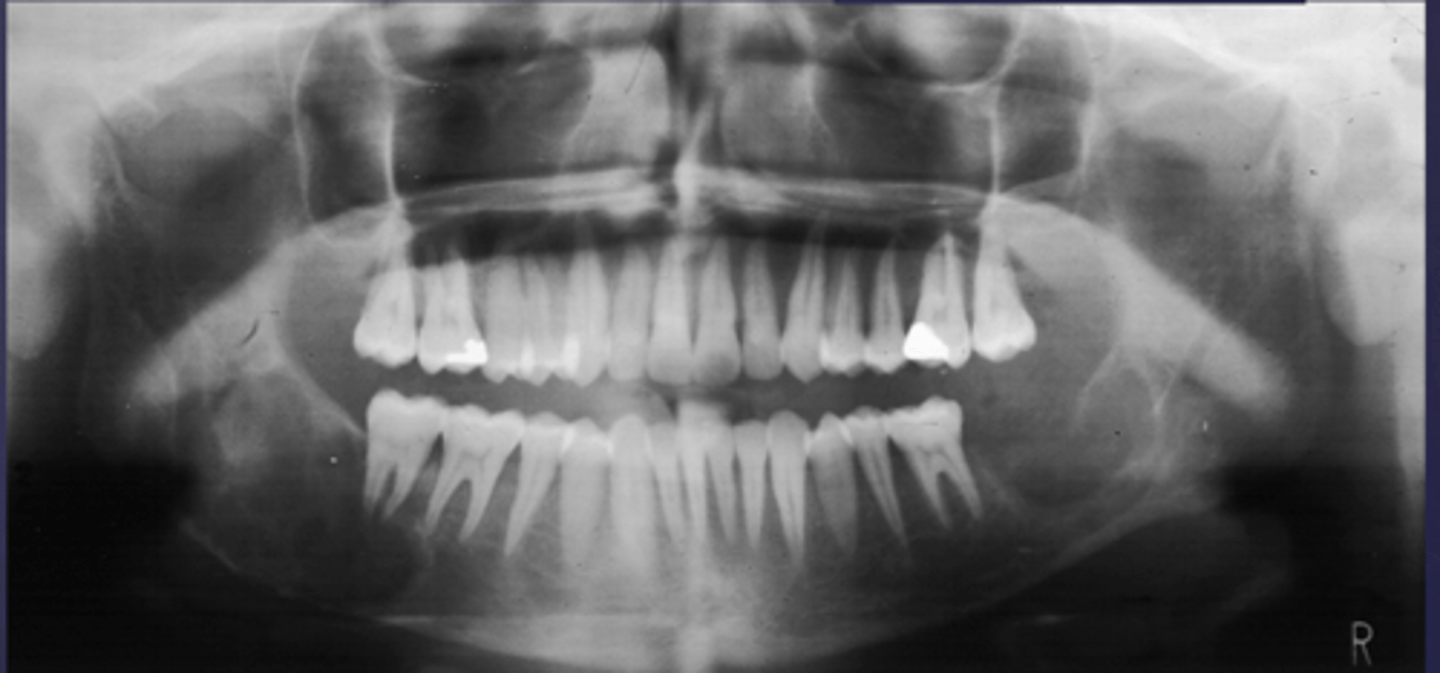 <p>What category would this lesion be part of?</p>