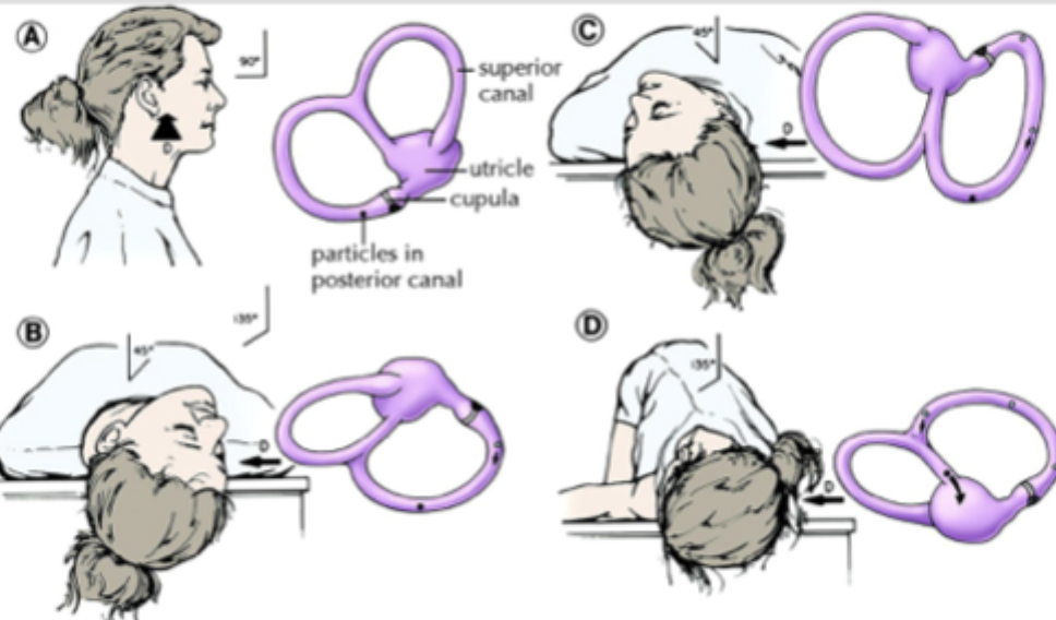 <p>Gameplan for peripheral vertigo</p>