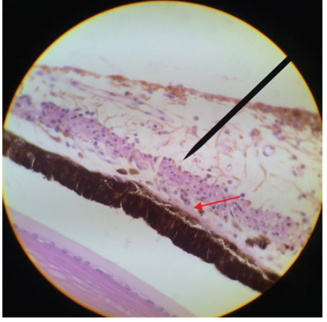 <p>the dilator muscle is present from the iris root to a point in the stoma below the midpoint of the sphincter </p><p>the dilator muscle causes the pupil to get bigger in low-light conditions (mydriasis)</p><p>the anterior iris epithelium continues posteriorly as the pigmented epithelium of the ciliary body </p>