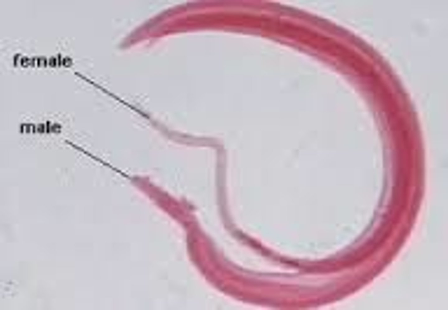 <p>Human Blood Fluke</p>
