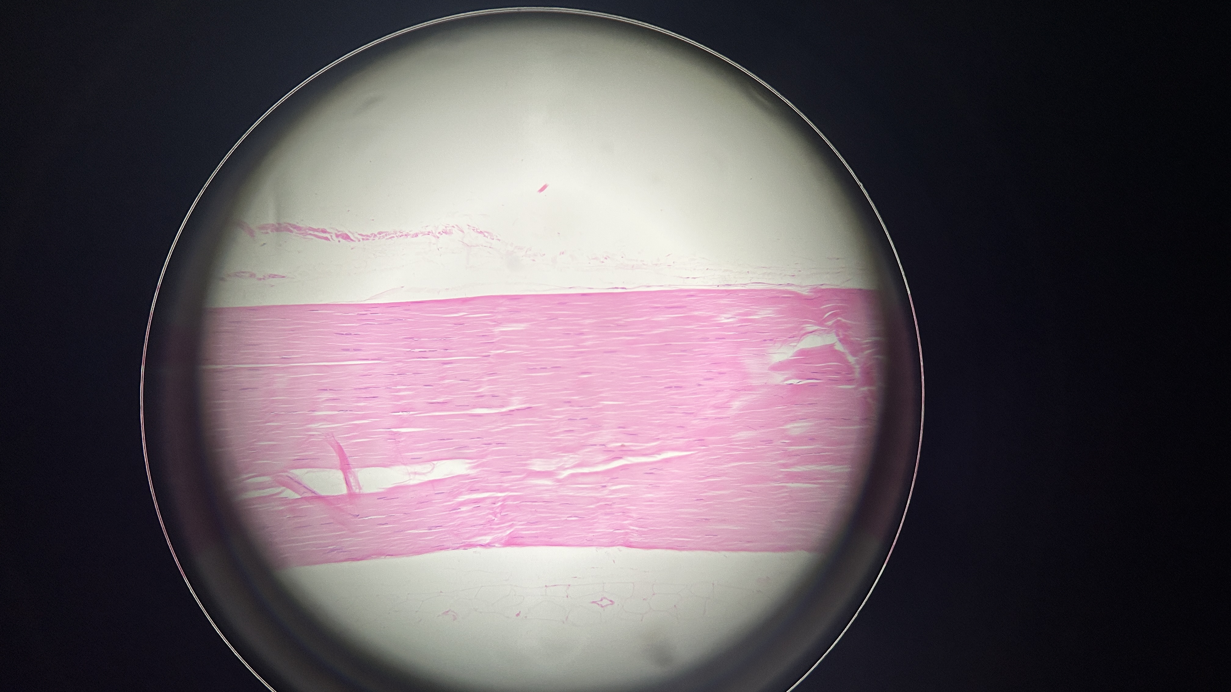 <p>What is the magnification level of the Dense Regular CT?</p>