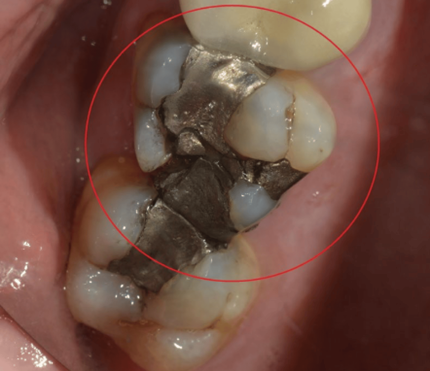 <p>What caused this defect?</p>