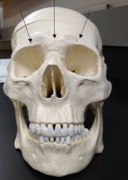 <p>What is the this bone (holes around eyebrow)?</p>