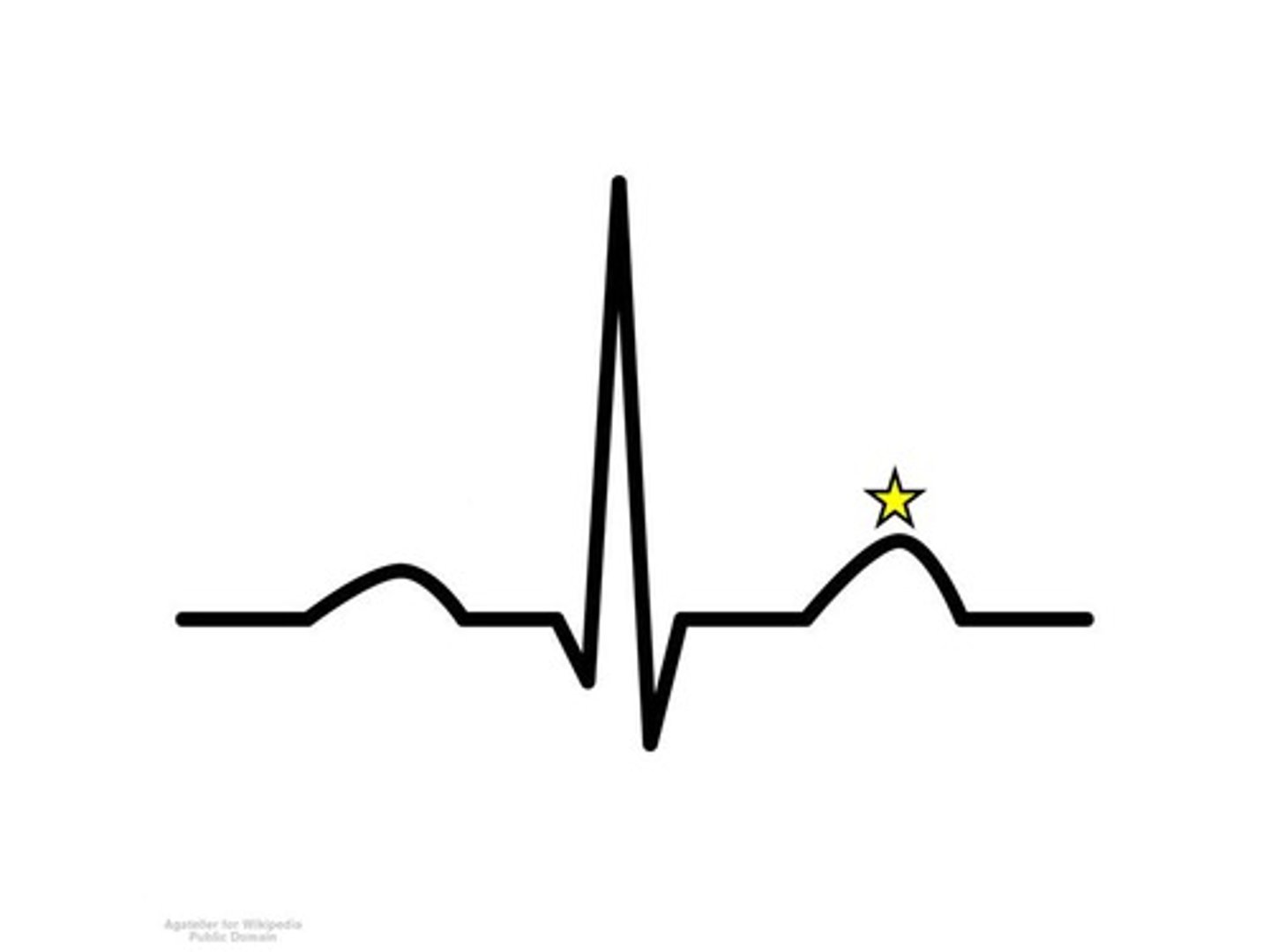 <p>name and what is happening</p>