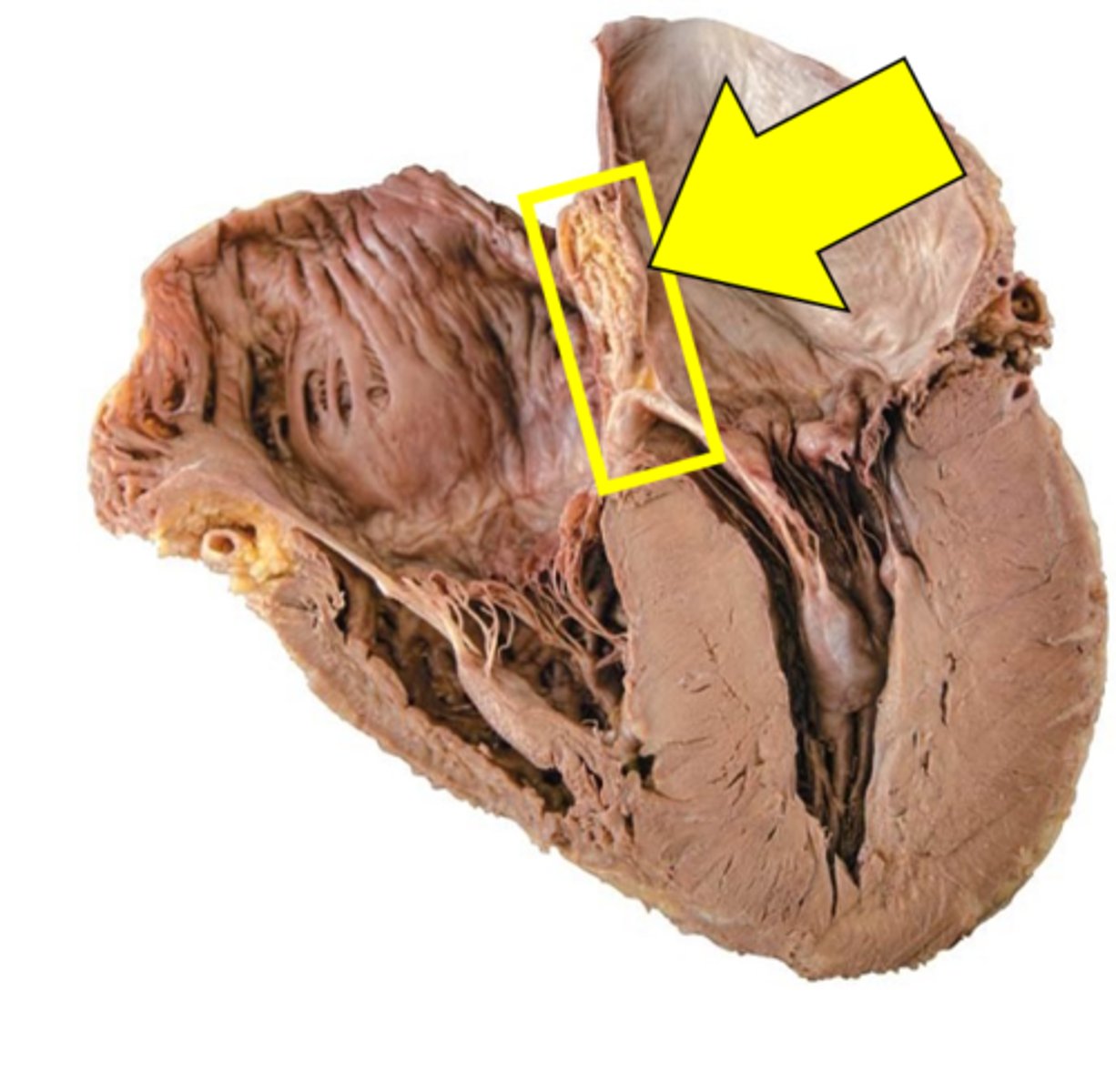 <p>Name the structure.</p>