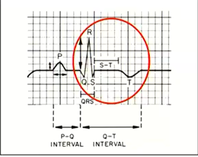 <p>What is heart here?</p>