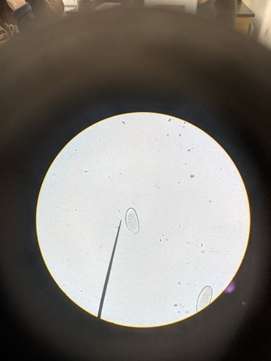 <p>- pinworm</p><p>- very abundant like grains of rice</p><p>- egg shape with one flat side</p><p>- larvae worm folded in half</p><p>-transparent shell</p><p>Eggs = infective form</p><p>dx: fecal exam for eggs / scotchtape method</p>