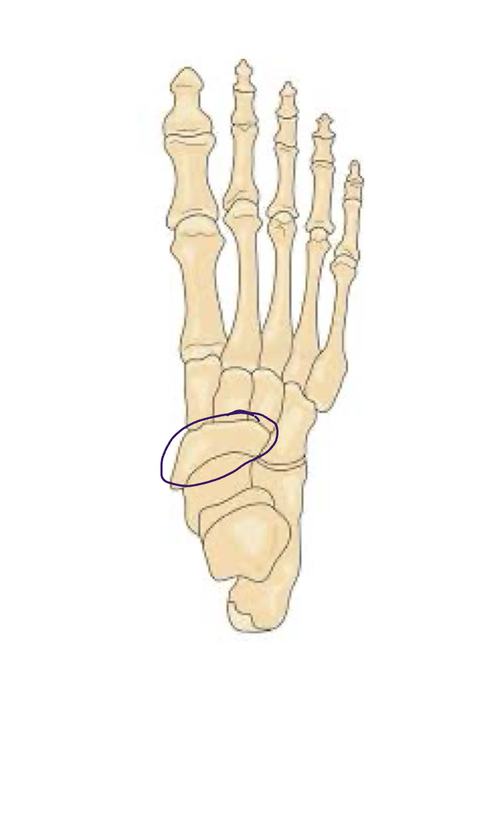 <p>Aligns with big toe</p>