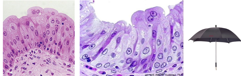 <p>large surface cells, often binucleate (unique to urinary system aka urothelium)</p>