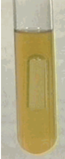 <p><span style="font-family: "Times New Roman";"><strong><span>Nitrate Reduction Test</span></strong></span></p>