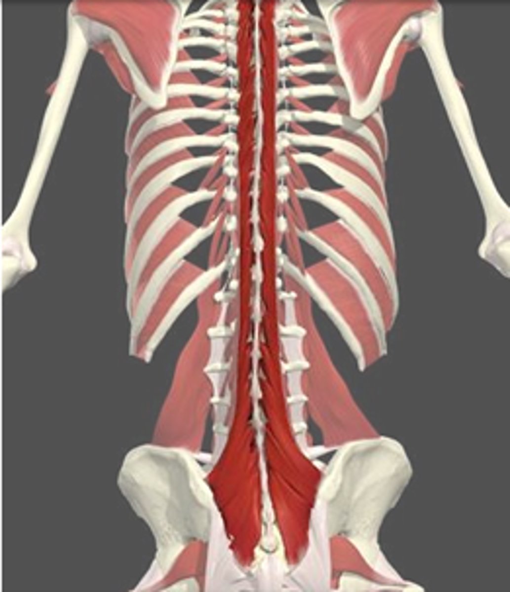 <p>stabilises vertebral column (most prominent in lumbar area)</p>
