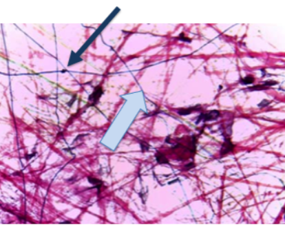 <ol><li><p>Tissue Type</p></li><li><p>Locations found</p></li><li><p>location specific functions</p></li><li><p>What is the black arrow pointed to and what is its function?</p></li><li><p>What is the EC component at the blue arrow</p></li></ol><p></p>