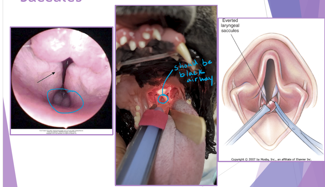 <ul><li><p>prolapse of mucosa lining the laryngeal crypts </p><ul><li><p>response to chronic high upper airway pressures </p></li></ul></li><li><p>least common of the BAS complex </p></li><li><p>why a concern </p><ul><li><p>further inhibit airflow, increases mucosal irritation </p></li><li><p>first stage of <strong>laryngeal collapse </strong></p></li></ul></li><li><p>surgical technique - cut them out but careful of vocal folds </p><ul><li><p>extubate the patient temporarily </p></li><li><p>grasp and pull with forceps </p></li><li><p>resect saccule at its base with metzenbaum scissors </p></li><li><p>bleeding is controlled with direct pressure (from the ET tube) </p></li></ul></li><li><p>happens due to chronic stress </p></li></ul><p></p>
