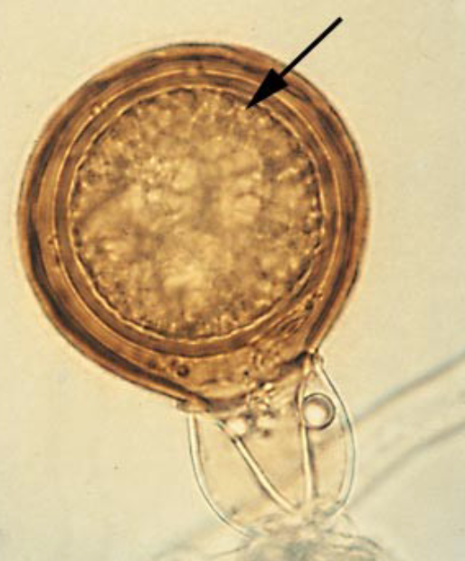 <p>what type of sexual spore is this</p>