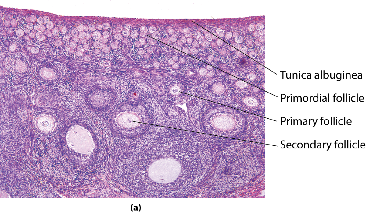<p>What is the organ pictured?</p>