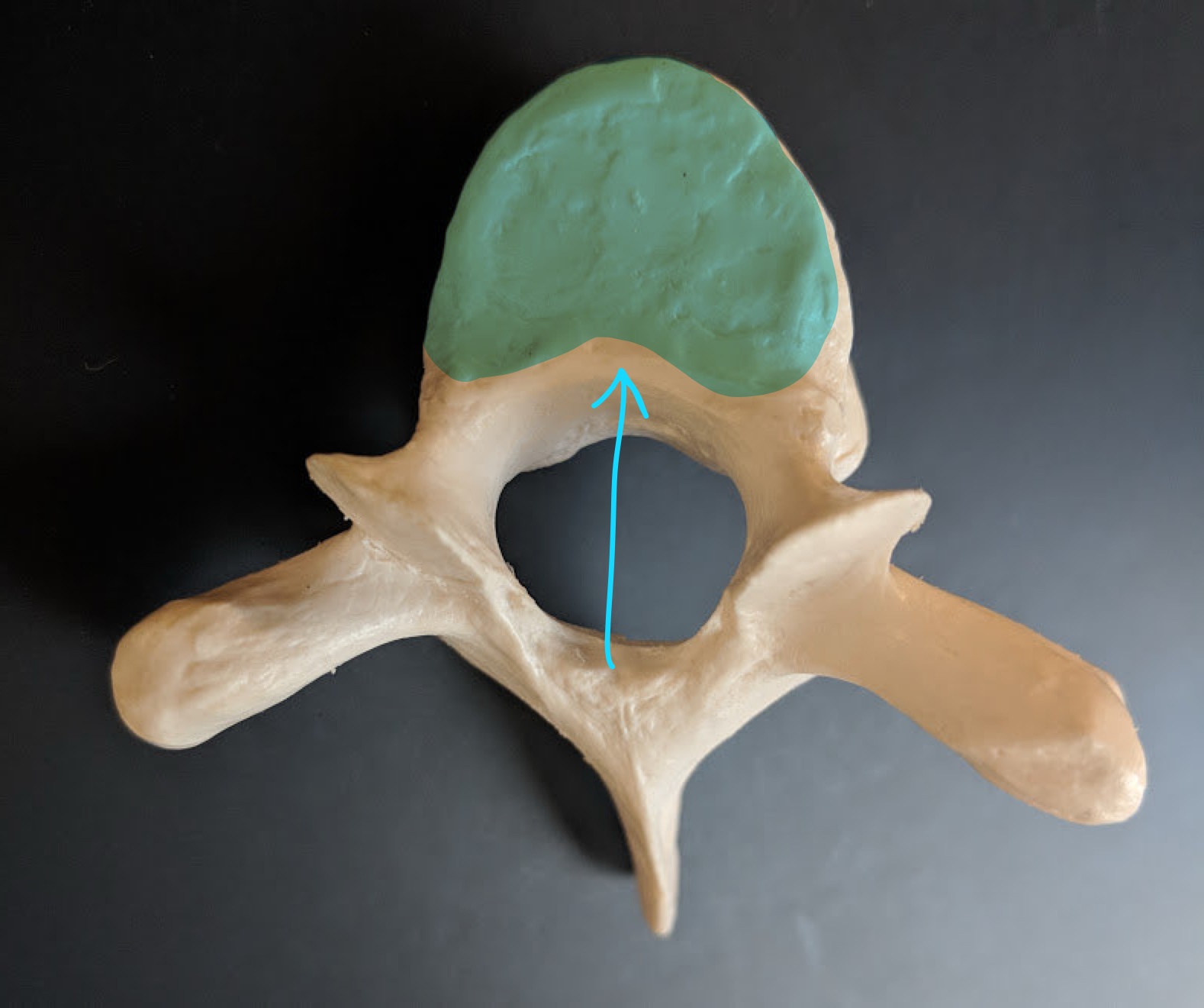 <p>Name this structure</p>