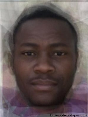 <p>Identify this Phenotype</p>