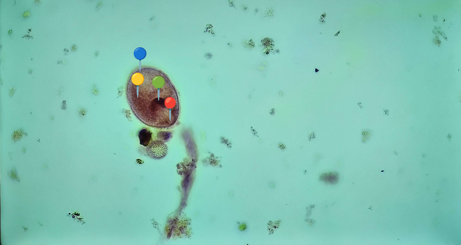 <p><strong><em>Balantidium coli</em></strong></p><p>(Trofozoit)</p><p></p><p></p><p><strong>Organelle:</strong></p><p></p><ul><li><p><span data-name="blue_circle" data-type="emoji">🔵</span><span> - cytopyge;</span></p></li></ul><p></p><ul><li><p><span>🔴🟡🟢🔵🟣⚫️⚪🟤</span></p></li></ul><p></p><ul><li><p><span>🔴🟡🟢🔵🟣⚫️⚪🟤</span></p></li></ul><p></p><ul><li><p><span>🔴🟡🟢🔵🟣⚫️⚪🟤</span></p></li></ul><p></p><p></p><p><strong>Parazytoza:</strong> <em>Balantydioza</em></p><p></p>