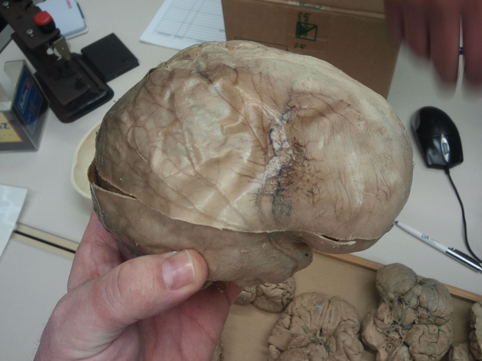 <p>Tough, outer layer of the meninges</p>