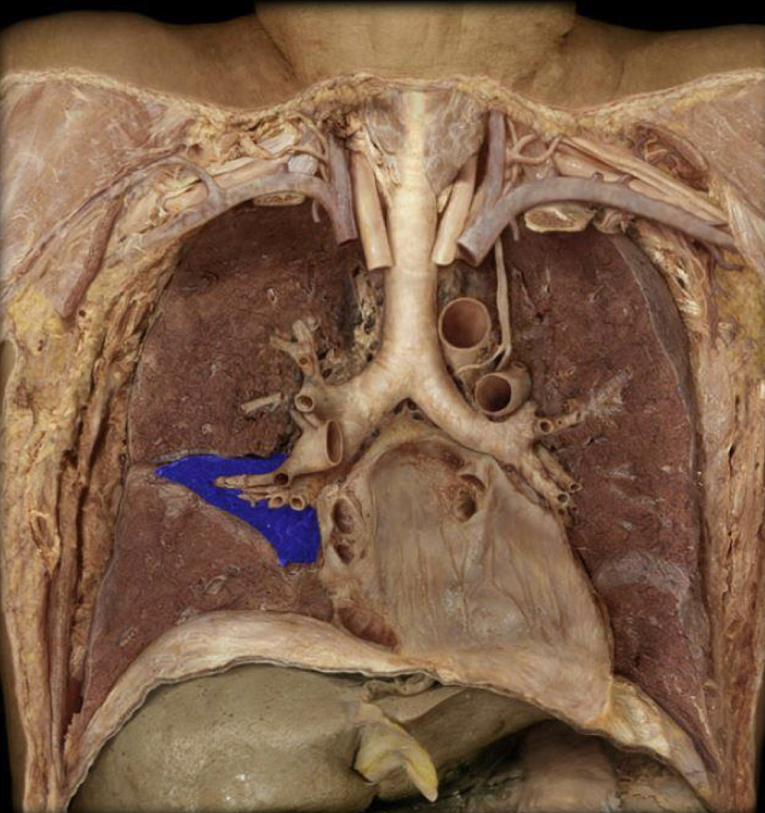 What structure is highlighted in blue?