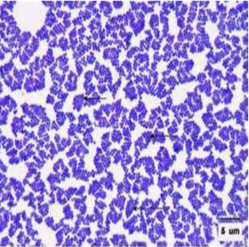 <p>Catalase +, Coagulase +, gram +</p><p>will appear gold on manitol-salt agar (aureus = gold)</p>