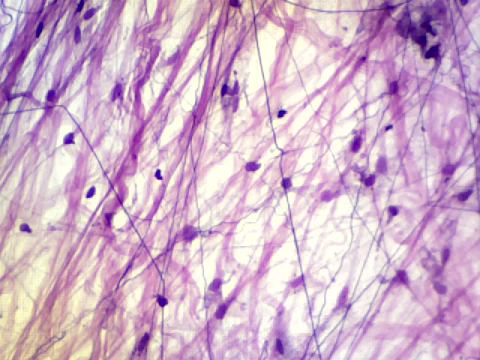 <p>what kind of tissue is this?</p>