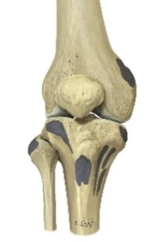 <p>The patella is a sesamoid bone that provides leverage for knee extension.</p>
