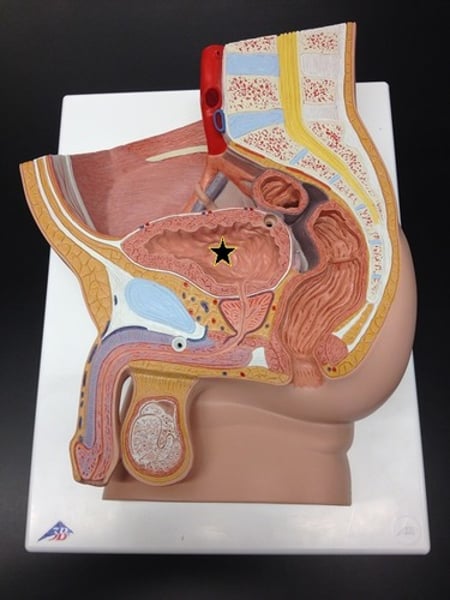 <p>Name the starred structure/organ.</p>