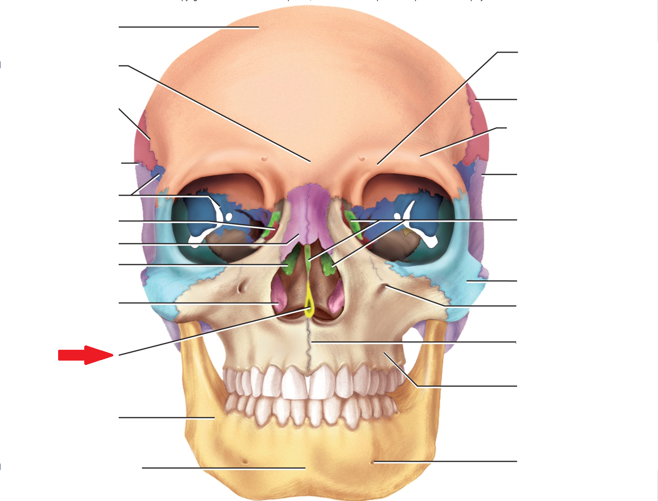term image