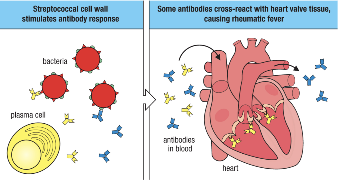 <ul><li><p>molecular mimicry (cross reactivity)</p><ul><li><p>non-self antigens resemble self antigens</p></li><li><p>infection with non-self (often a virus) induces an immune response that also targets similar looking self-antigens</p><ul><li><p>basically, lymphocytes will target both the viral and self-antigens that look viral</p></li></ul></li></ul></li></ul><p></p>