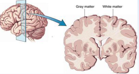 <p><span>Grey Matter: Somas (cell bodies) and Dendrites</span><br><span>White Matter: Myelinated axons</span></p>