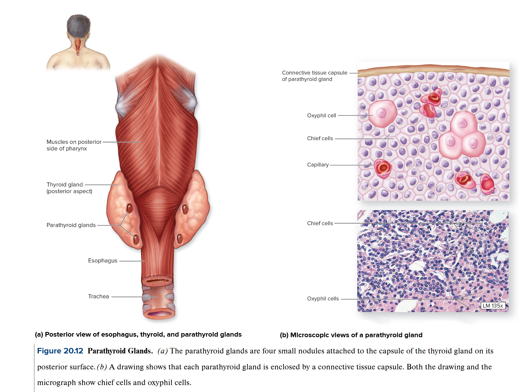 <p>Parathyroid glands</p>