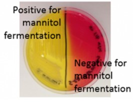 <ul><li><p>selective for staphylococcus and is differential for staphylococcus aureus from other staphylococci.</p></li><li><p>SELECTIVE: salt tolerant organisms -DIFFERENTIAL: mannitol fermentation; changing the pH indicator</p></li></ul><ul><li><p>Growth on Media- organism is tolerant</p></li><li><p>Mannitol fermentation- media changes from yellow to red</p></li><li><p>Non-Mannitol fermentation- media remains red</p></li></ul>