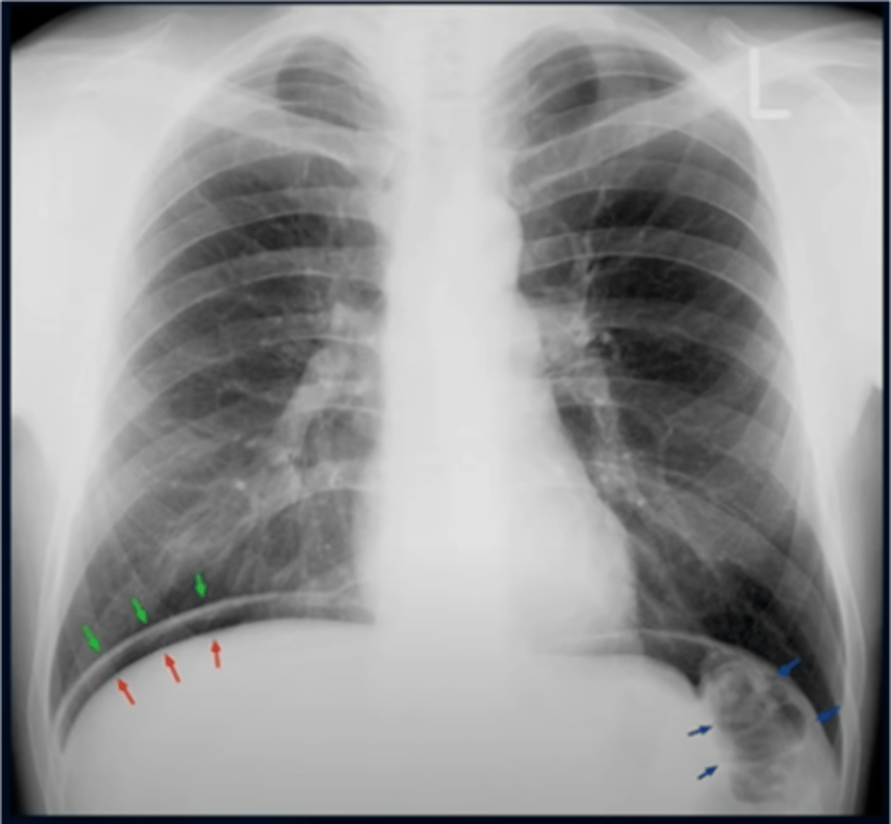 knowt flashcard image