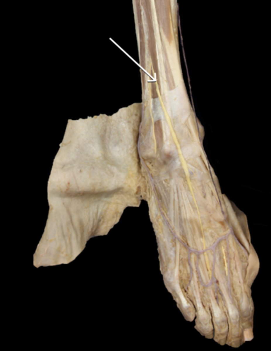 <p>Identify the nerve</p>