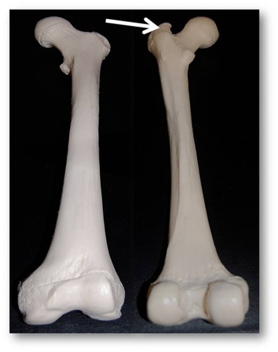 <p>Name this specific part of the femur.</p>