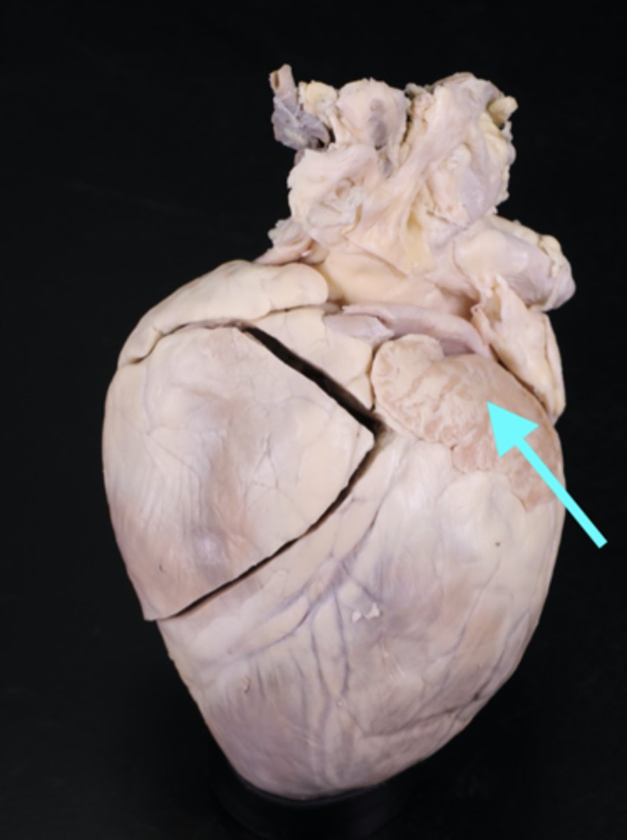 <p>Description: Lumpy and wrinkled flap (ear-like extensions) of the atria</p><p>Relationship: Allows for the atria to expand when filling with blood</p>
