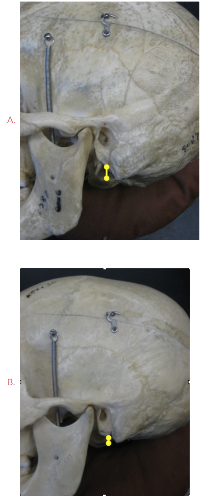 <p><span>Look at the mastoid processes, which of these skulls is male? Answer: A or B</span></p>