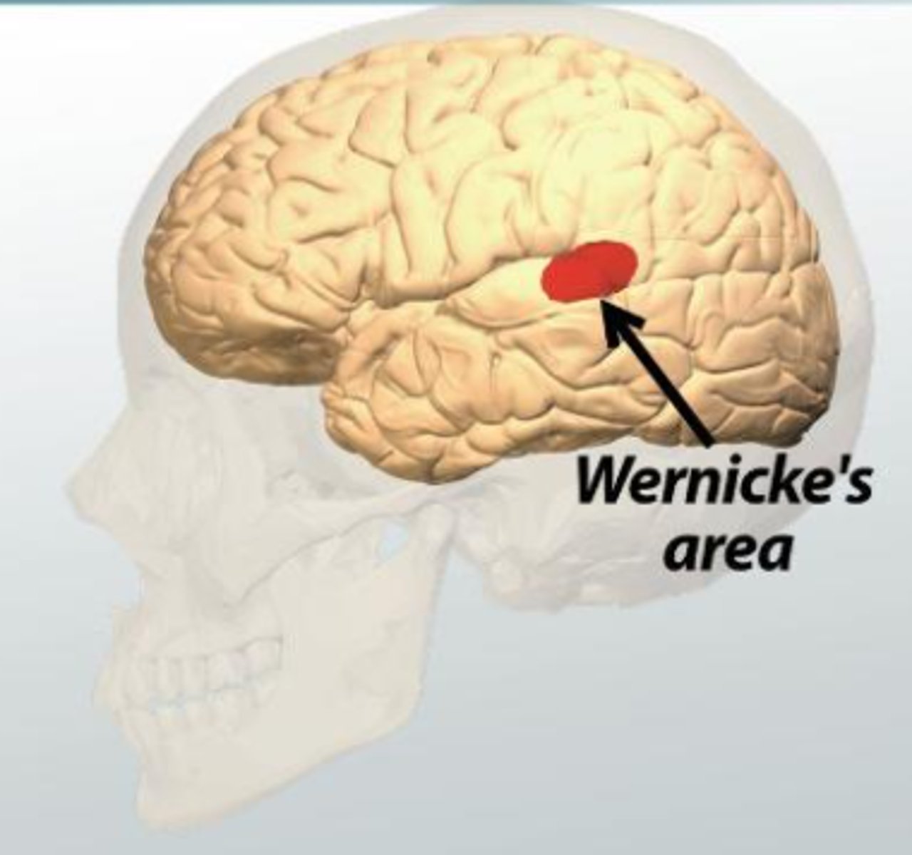 <p>- tylna część zakrętu skroniowego górnego i sąsiedni obszar płacika ciemieniowego dolnego półkuli dominującej</p><p>- afazja czuciowa (nie rozumiemy mowy, możemy mówić, ale szybko i używając nieodpowiednich słów)</p>