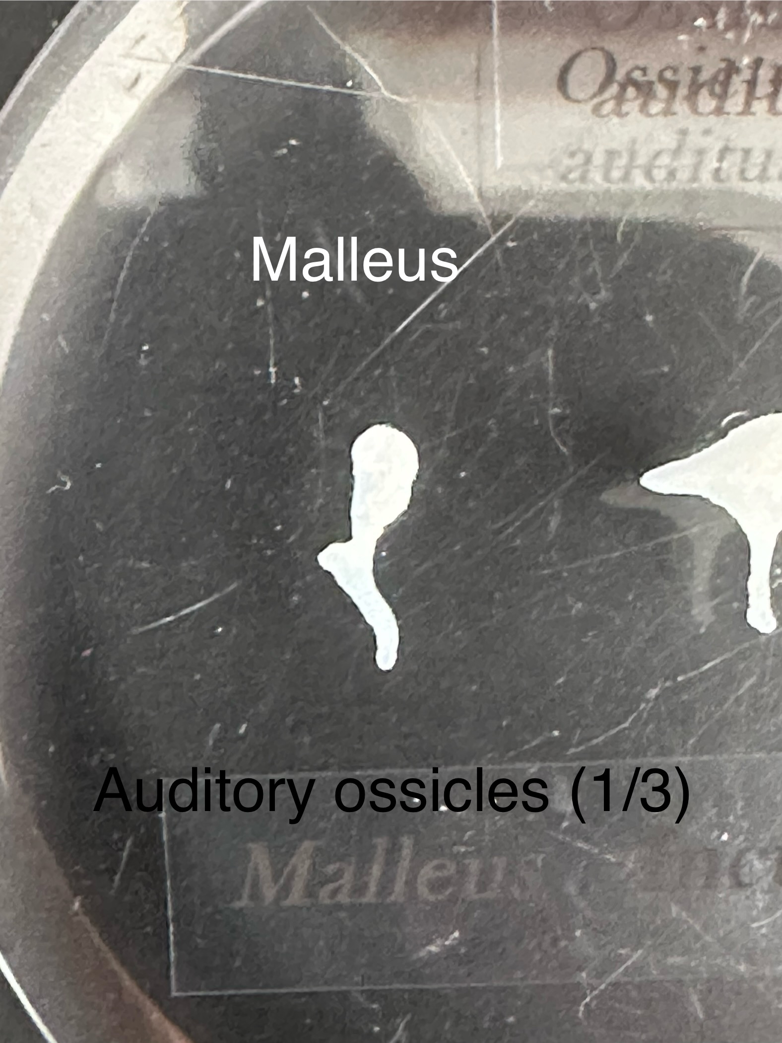 <p>Malleus: auditory ossicles</p>