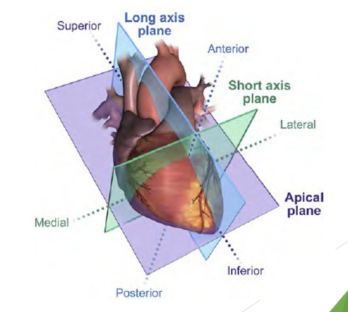 <p>Long axis plane (LAX) divides the heart into left and right</p><p>Short axis plane (SAX) divides the heart into inferior and superior portion (perpendicular to above plane)</p><p>Apical or 4 chamber plane -runs parallel to anterior andposterior surfaces and divides the heart into four chambers</p>