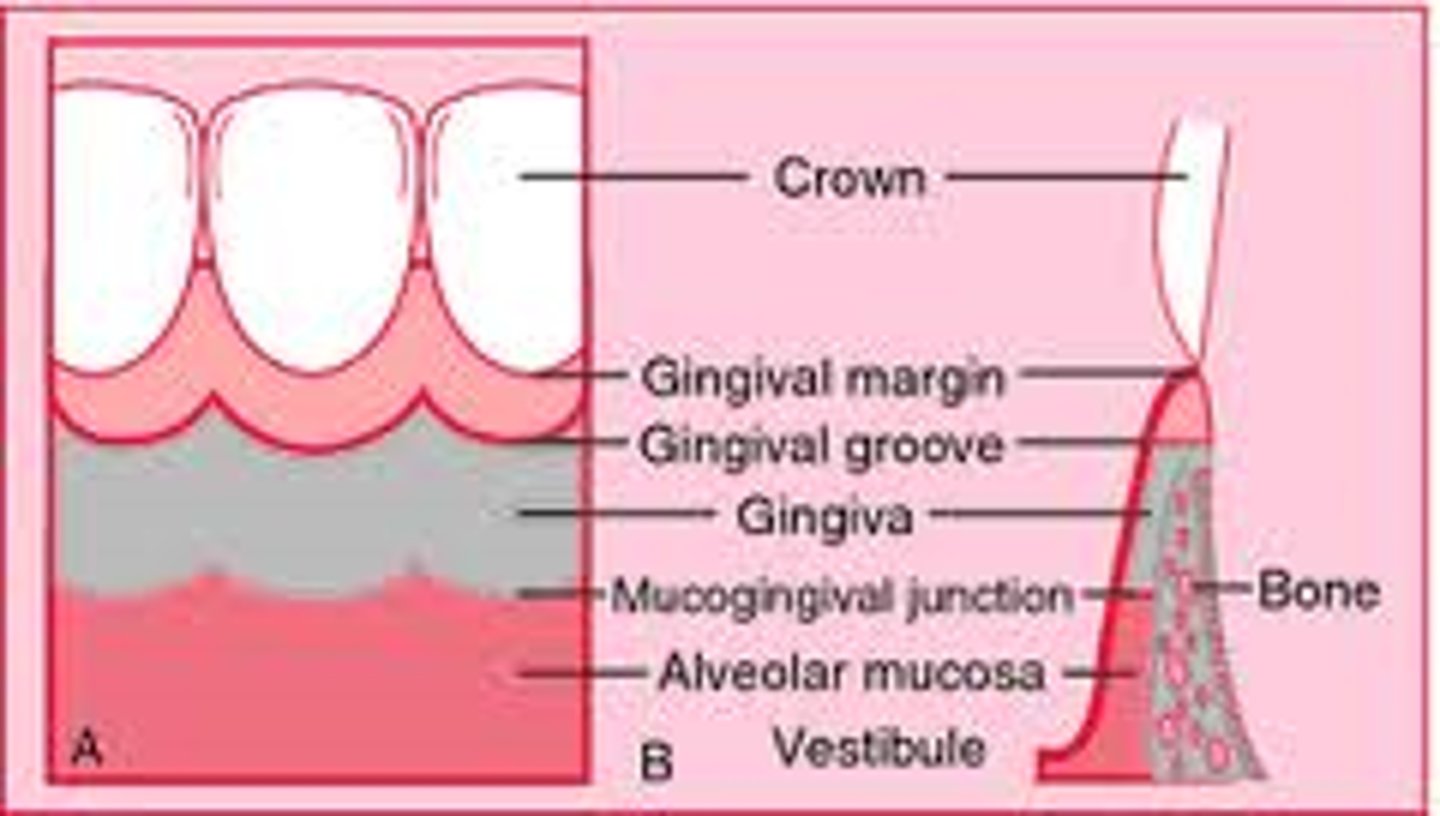 <p>shallow linear depression that separates the free and attached gingiva (can be hard to see with the naked eye)</p>
